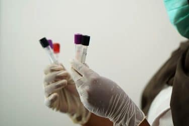 A close up of gloved hands holding medical sample tubes